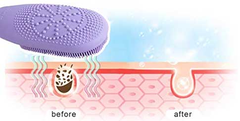 Kinetic Skin Cleansing Systems Helps to Gently Massage and Tone Skin Plus Open Pores